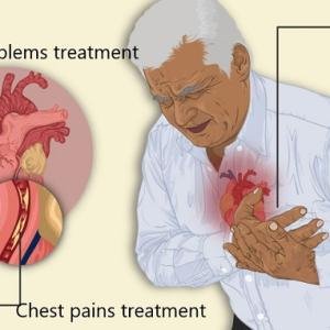 Cardiac Arrest Treatment Medication in Accra, Ghana