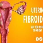 A Fibroid Treatment Medication: Shrink Fibroids Naturally Without Surgery