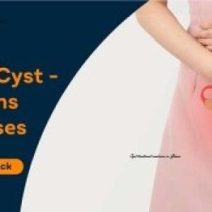 Ovarian Cyst Treatment Supplements & Natural Antibiotics in Accra, Ghana