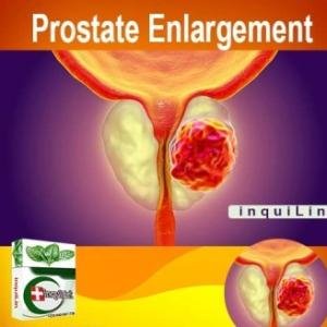 Prostate Enlargement Treatment Supplements in Accra, Ghana