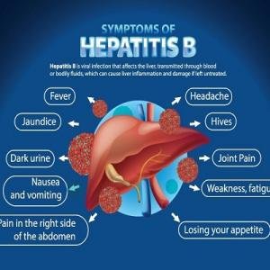 Hepatitis B Treatment Medication in Accra, Ghana