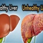 Main Functions of the Liver and Natural Remedies For Liver Detoxification