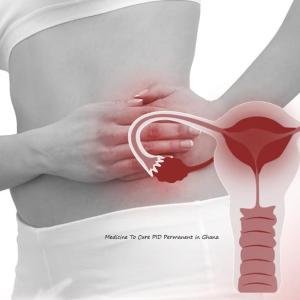 Pelvic Inflammatory Disease (PID) Treatment Medicine in Accra, Ghana