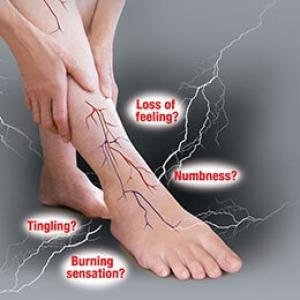 Neuropathy Pain Treatment Medication in Accra, Ghana