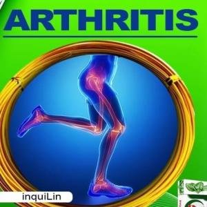 Rheumatoid Arthritis and Jaundice Treatment Medication in Accra, Ghana